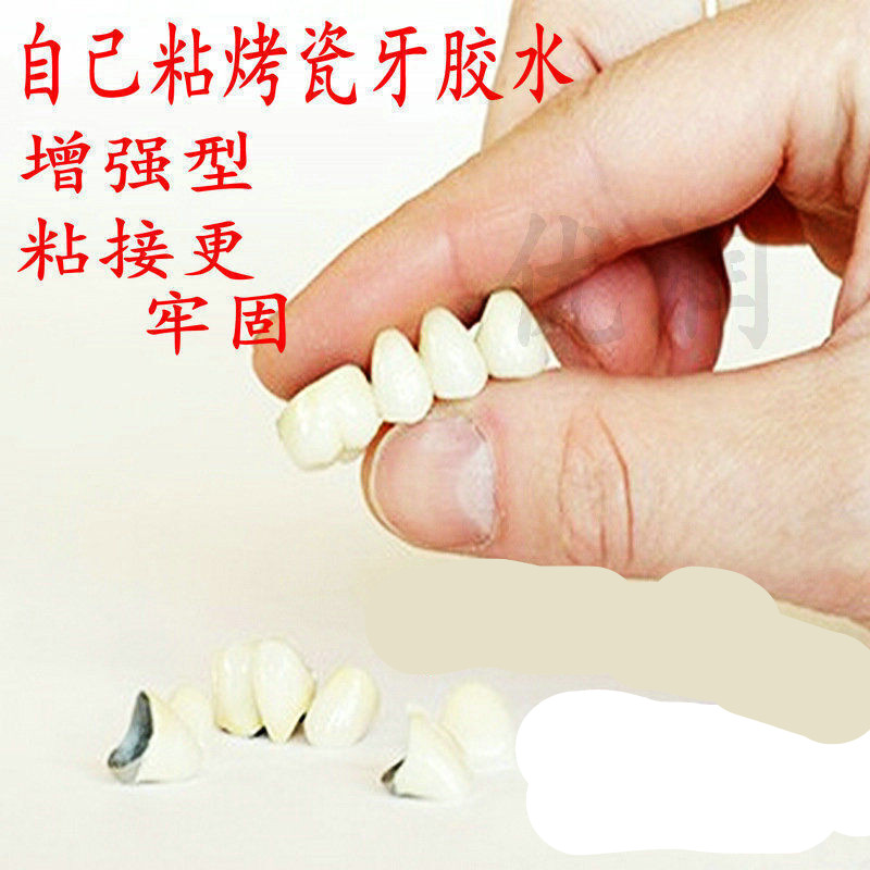 自己动手粘烤瓷牙胶水牙齿钢牙套合金牙冠假牙粘合胶水粘接剂材料