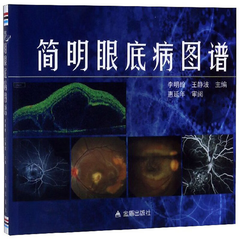 简明眼底病图谱