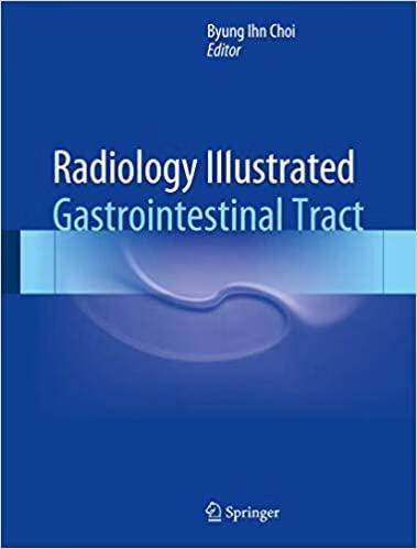 预订radiology illustrated: gastrointestinal tract