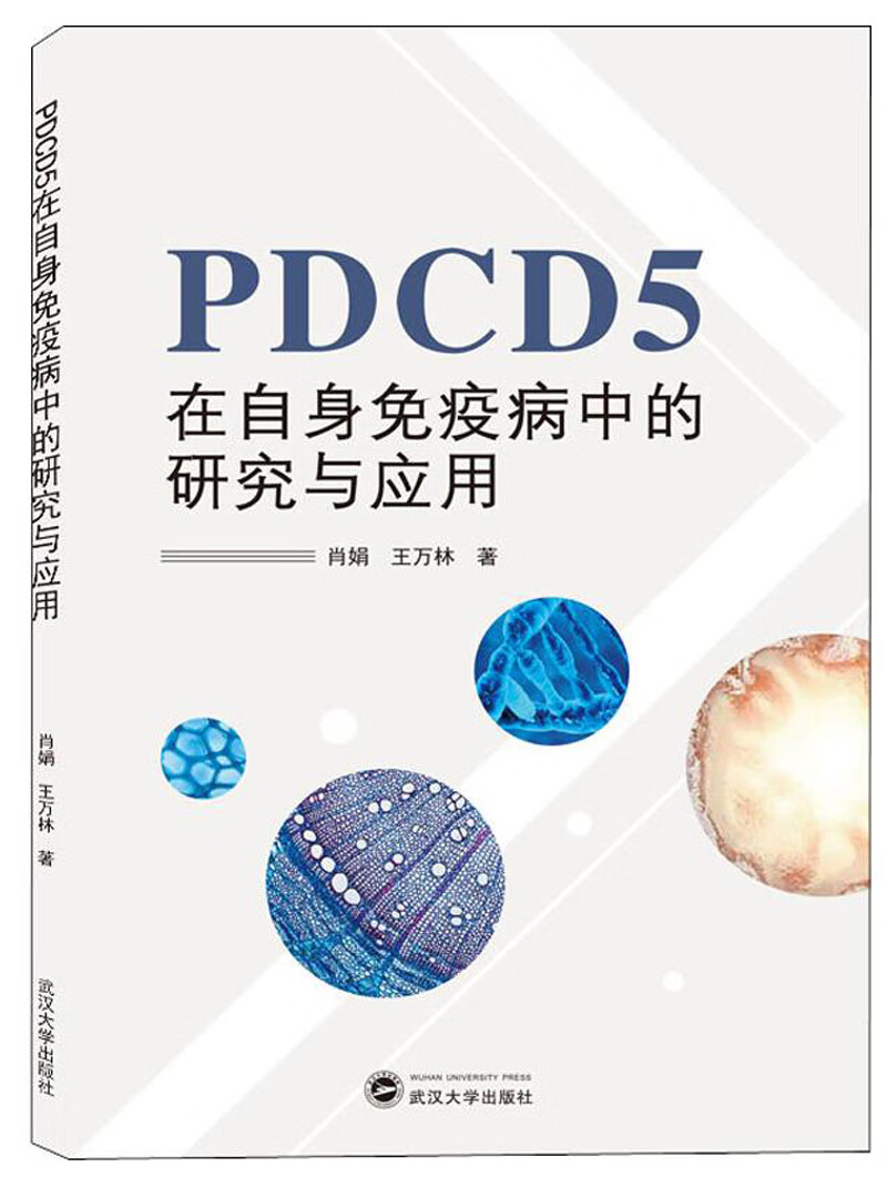 PDCD5在自身免疫病中的研究与应用