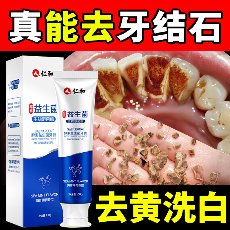 胖东来牙膏亮白护齿牙膏清洁牙渍牙垢去口臭牙黄垢斑异味清新口腔 1支装轻度牙结石