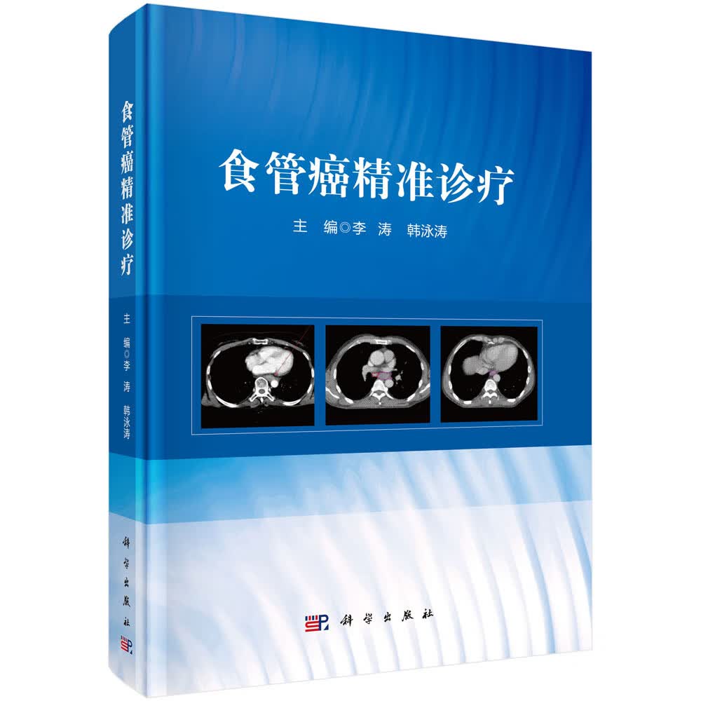 食管癌精准诊疗