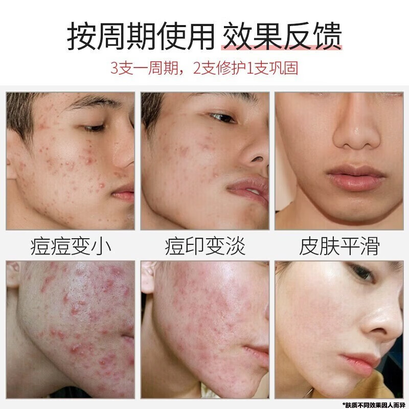 宫本武藏山茶花氨基酸洗面奶控油祛痘去黑头烟酰胺保湿补水提亮肤色洁面乳 2瓶装【推荐装】