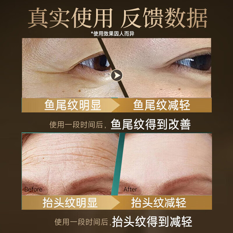 南京同仁堂抗皱面霜紧致提拉六胜肽多肽淡化细纹皱纹法令抬头纹男女专用 买2送1抗皱面霜-淡化细纹