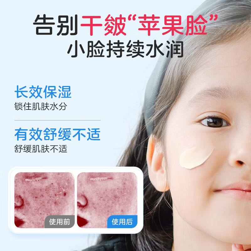 小浣熊儿童青蒿精粹舒缓霜75g补水保湿润肤乳新生婴幼儿脸部滋润 【水润舒缓】儿童青蒿精粹霜75g