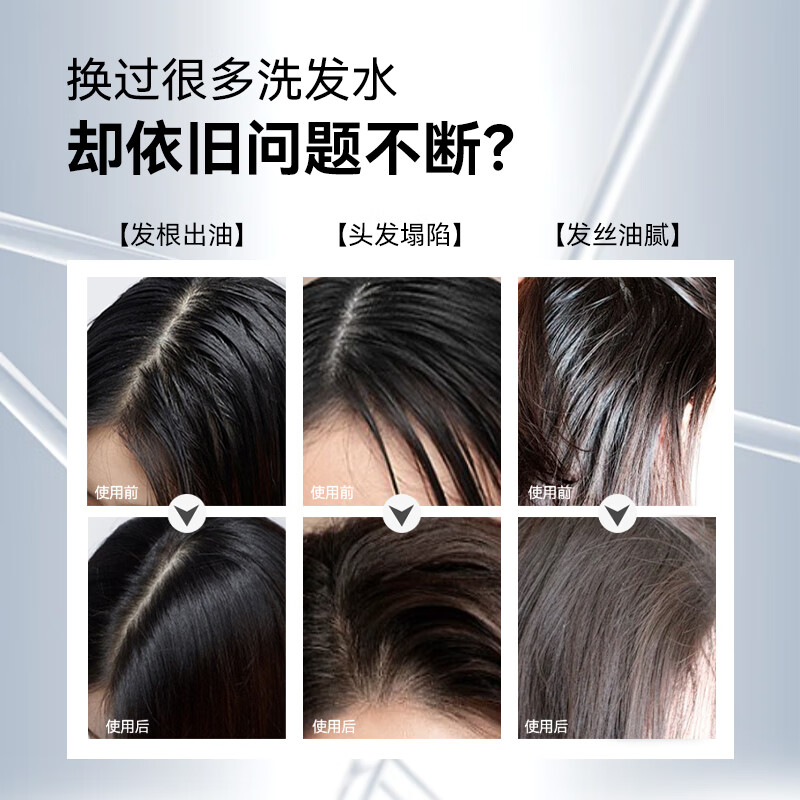 爱德兰丝头皮磨砂膏 深度清洁舒缓毛囊控油去屑蓬松洗发水洗头膏露男女士 头皮磨砂膏200g