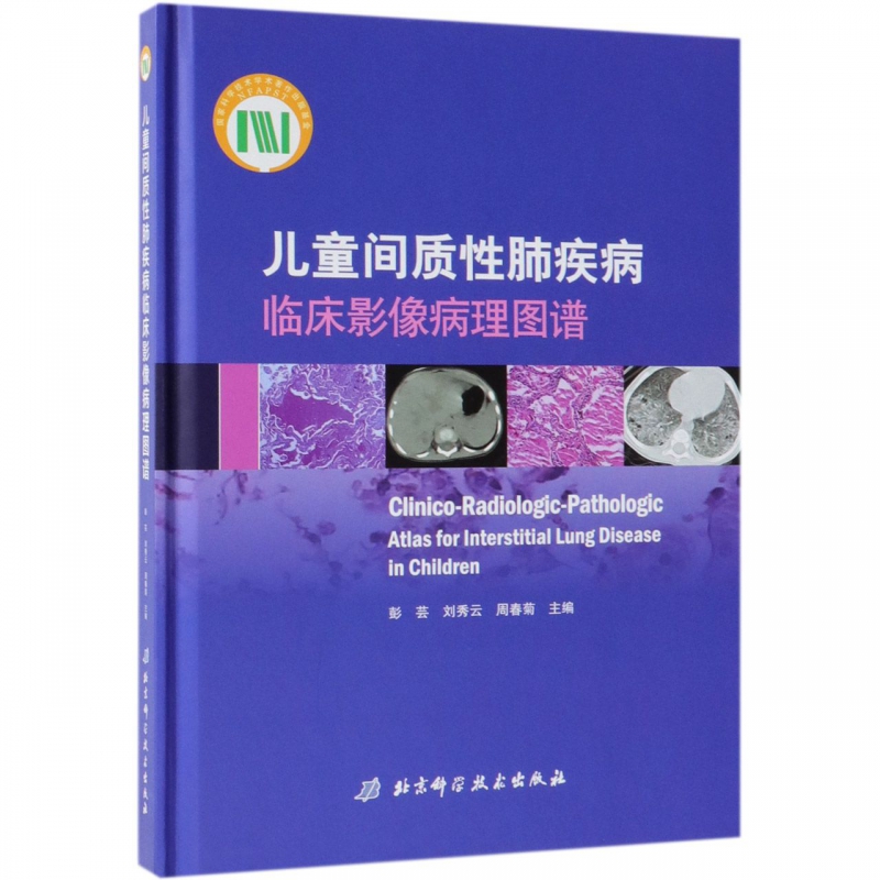 儿童间质性肺疾病临床影像病理图谱(精)