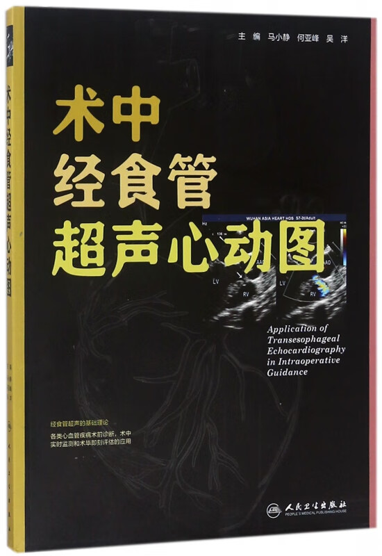 术中经食管超声心动图
