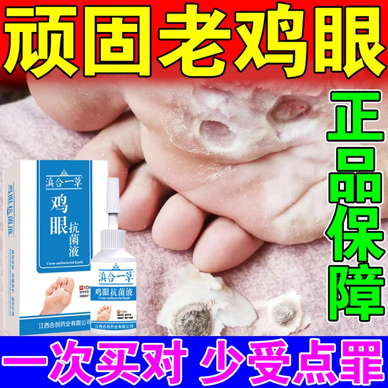 正康佰邦鸡眼膏去肉刺根成人脚底趾跖疣瘊子足部老茧软化鸡眼贴水杨酸