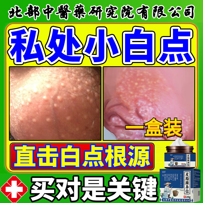 皮脂腺异位症增生龟头包皮黄白点丘疹颗粒阴茎小疙瘩专用膏男性 1盒