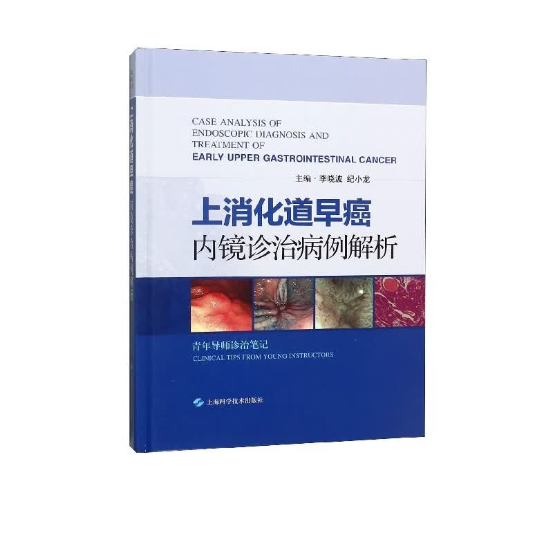 上消化道早癌内镜诊治病例解析(精)