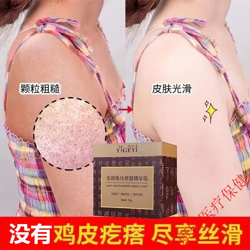 鸡皮肤用什么护理好(鸡皮肤用什么护理好一点)