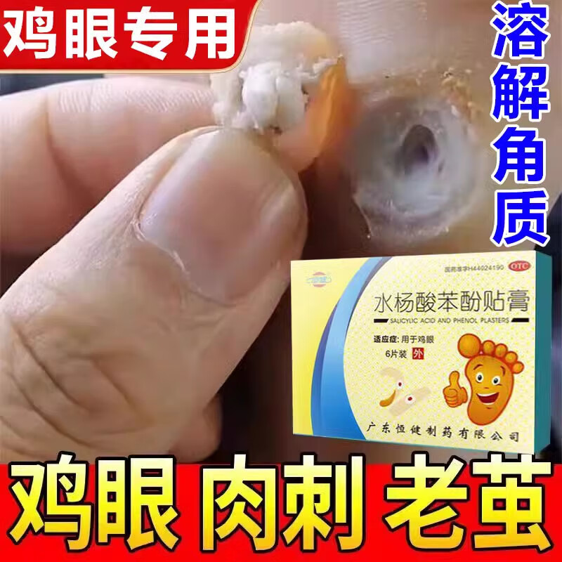 恒健 水杨酸苯酚贴膏祛鸡眼6贴/盒 抗菌消炎治疗手脚部老鸡茧肉刺用于