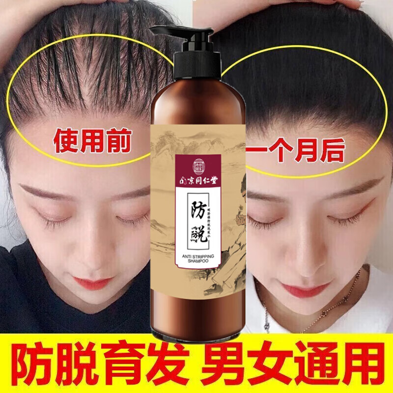 防脱育发洗发水防脱生发中药增发密发生姜洗发水何首乌控油蓬松防脱严重男女士增发密发固发掉发控油洗发水 1瓶装体验装 500ml大容量