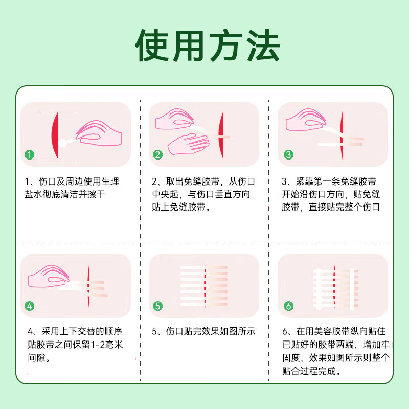 妥能医用免缝胶带 3m伤口减张贴 儿童脸部术后贴 剖腹产疤痕增生缝合贴 拉链式创口贴抗过敏透气胶布 免缝胶带12×100mm20袋/120条