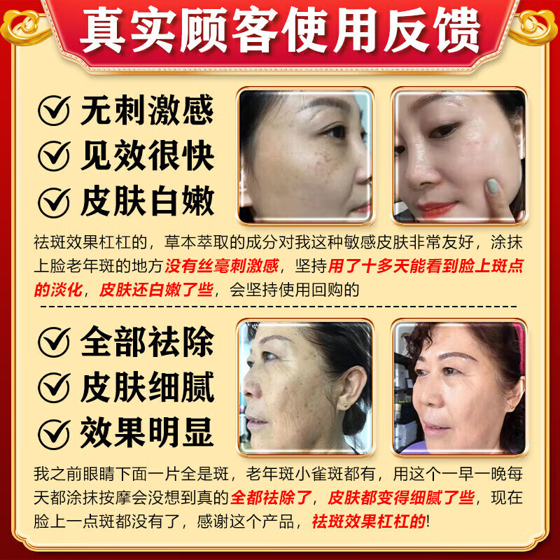 老年斑专用一夜消强力去除专用脸部手背祛斑霜专用强力去除沉淀祛 一盒