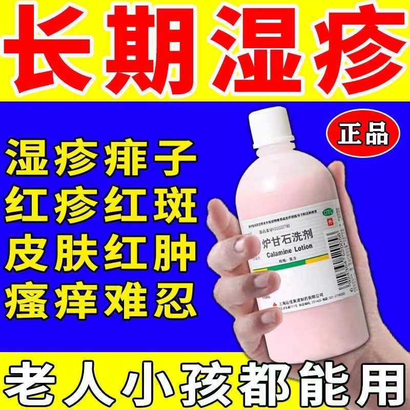 炉甘石可以治鸡皮肤(炉甘石能治皮肤瘙痒吗) 炉甘石可以治鸡皮肤(炉甘石能治皮肤瘙痒吗)