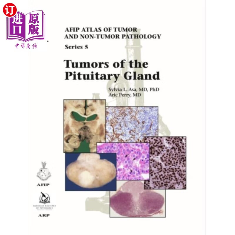 海外直订医药图书tumors of the pituitary gland 脑下垂体肿瘤