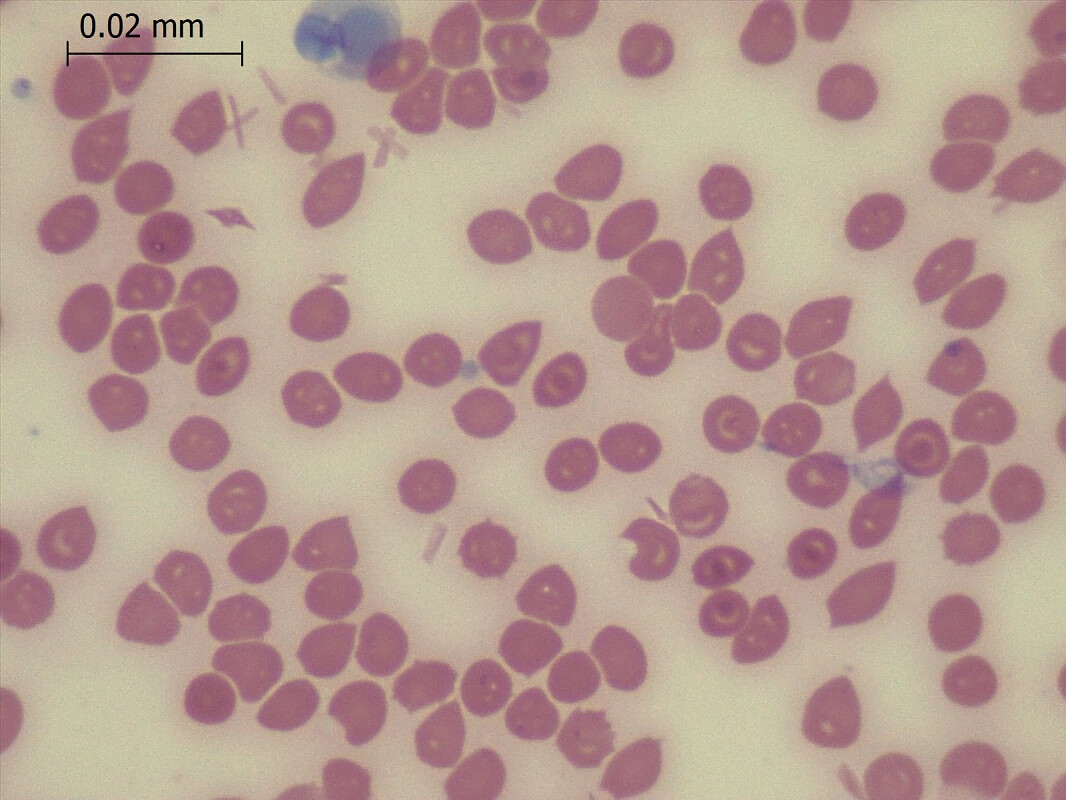 定制适用于diffquick迪夫快速细胞染色液固定液 排卵分泌物涂片现 3款