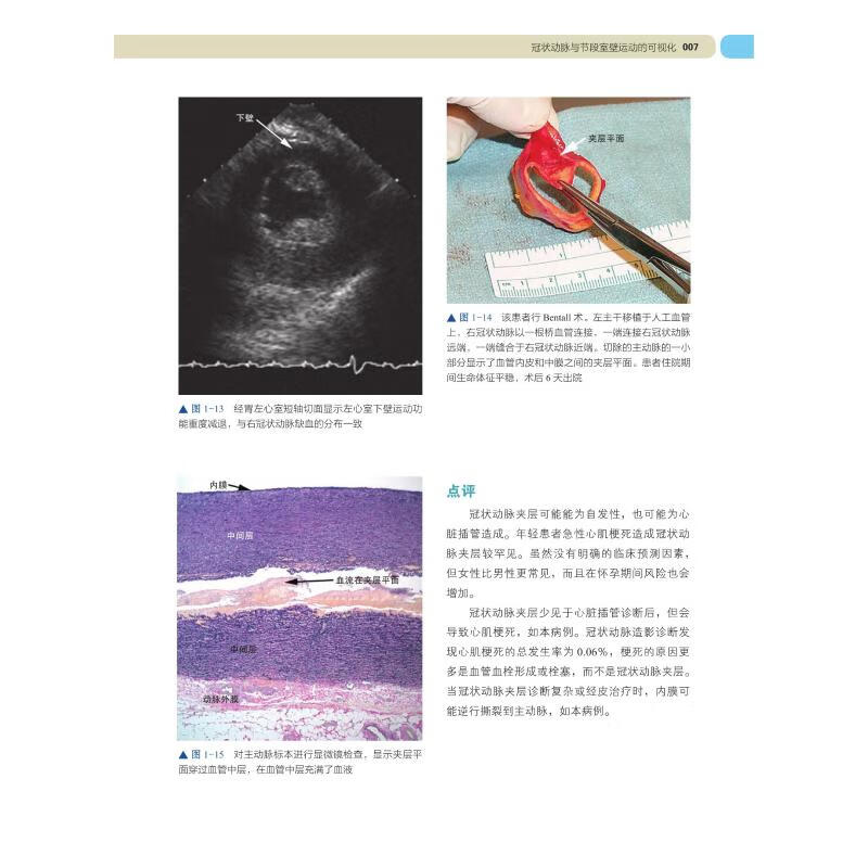 术中及介入声心动图 经食管影像图谱 原书第2版 典藏版 中国科学技术