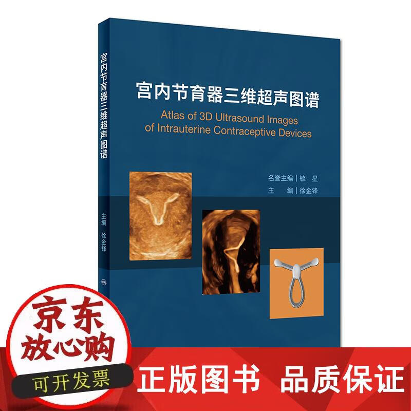 宫内节育器三维超声图谱 人民卫生出版社 徐金锋 著 9787117262088正版