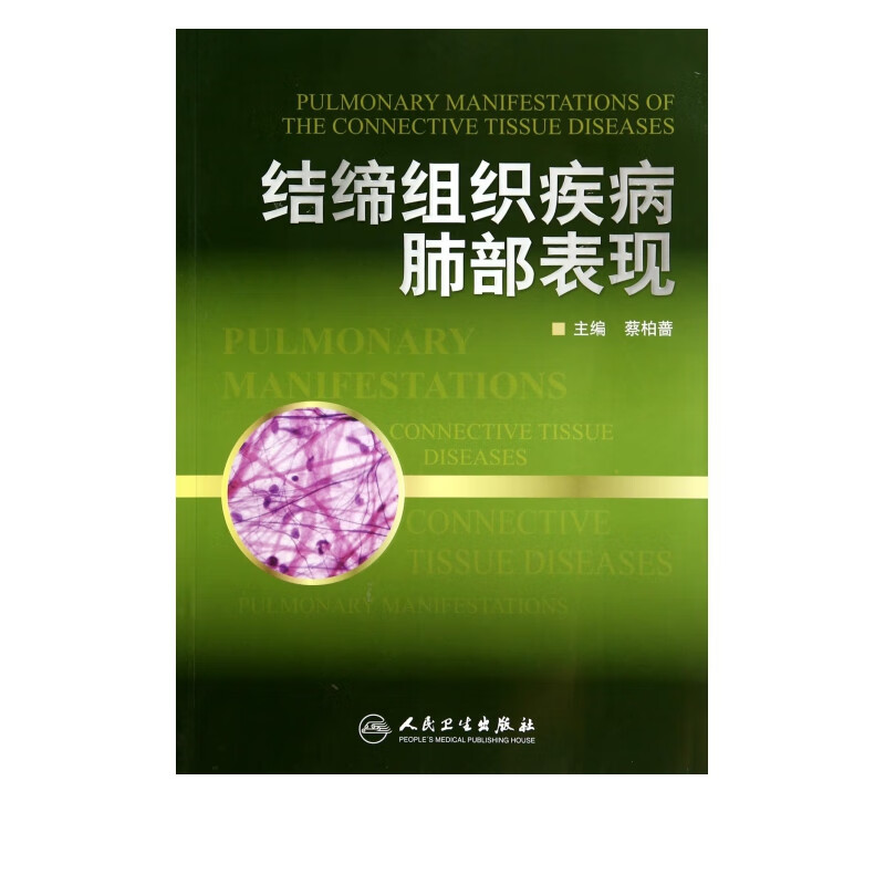 结缔组织疾病肺部表现