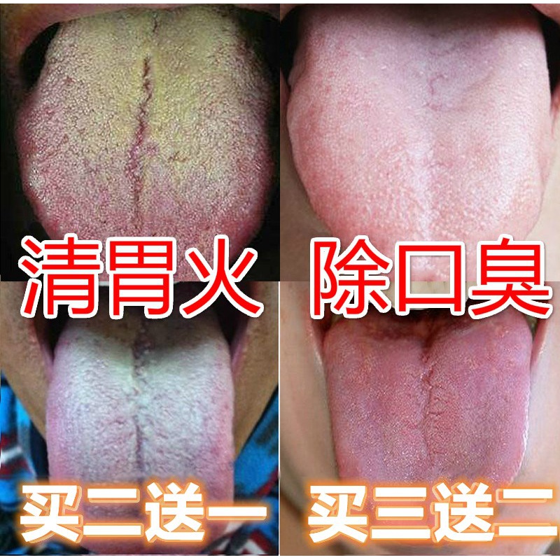 齿痕舌口臭茶早上起来口臭口苦口干舌燥旺盛齿痕舌调理口臭茶