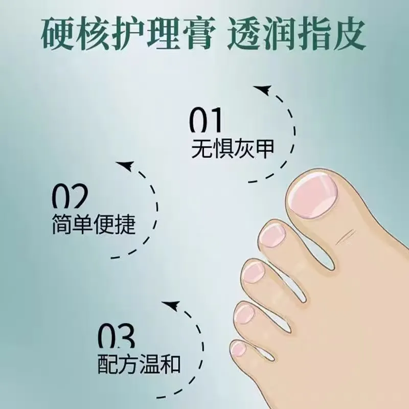 碧琢脚指头灰指甲膏灰指甲增厚严重灰指甲灰甲修复去厚甲空甲 2支