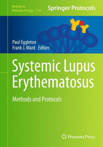 预订 systemic lupus erythematosus