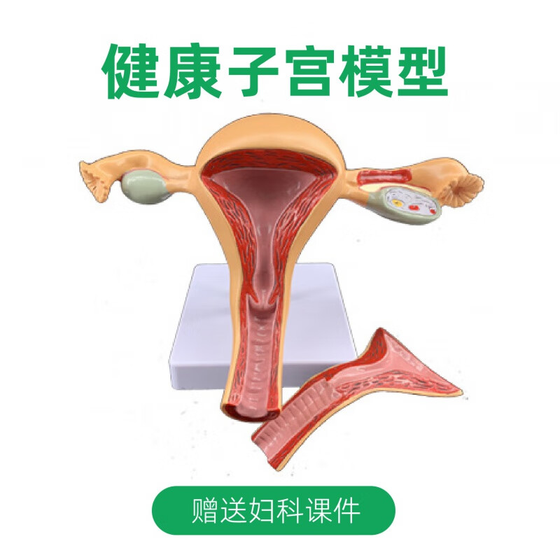 子宫卵巢模型病变生殖科妇科医用演示阴道结构解剖模具女性人体 健康