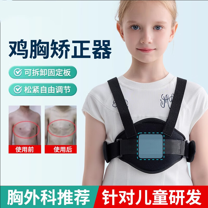 儿童鸡胸矫正器小孩幼儿漏斗胸收肋骨外翻固定带支具术后固定夹板