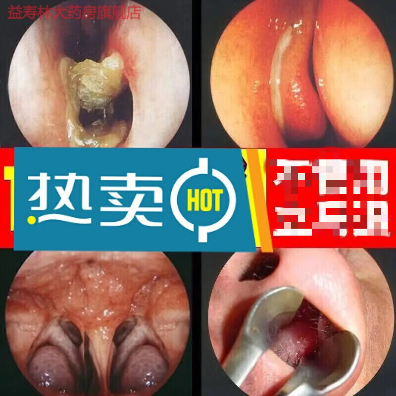 药店直售 鹅不食草鼻炎膏过敏性鼻炎神器鼻窦炎鼻塞通鼻鼻甲肥大ysl