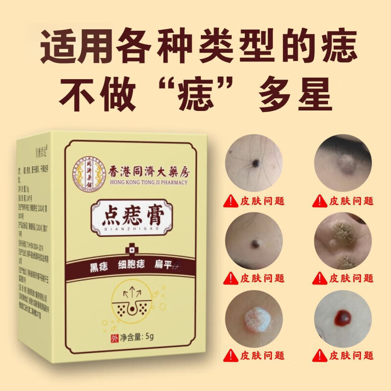 香港大药房香港大房点痣膏肉刺脂肪草本植物萃取黑痣痦子瘊子点斑膏 5瓶装[钜惠装]