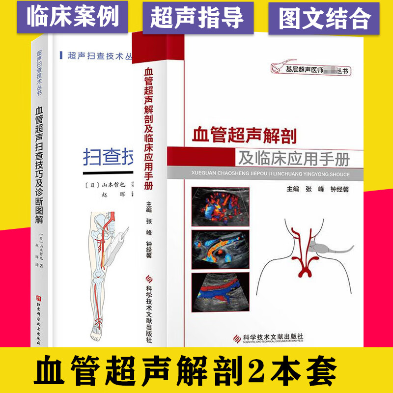 2本 血管超声解剖及临床应用手册+血管超
