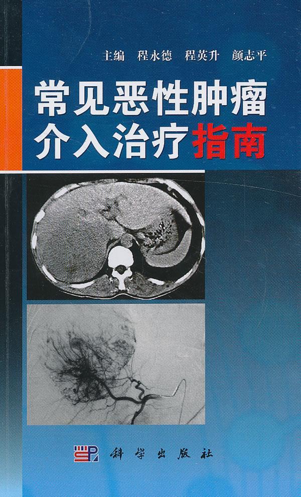 常见恶性肿瘤介入治疗指南 主编程永德, 程英升, 颜志平【正版】