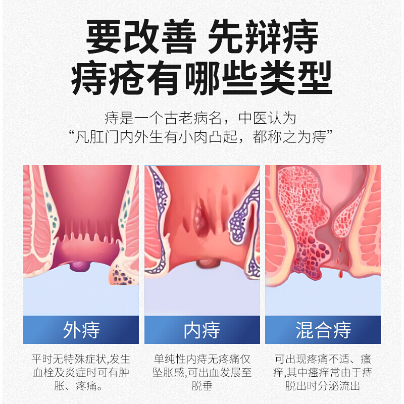 修正 医用敷料痔疮凝胶 痔疮膏去肉球肿内痔外痔疮混合痔疮治疗痔疮药肛门瘙痒便血肛裂坠涨脓肿息肉球脱肛 1盒 5g/支 x 4支