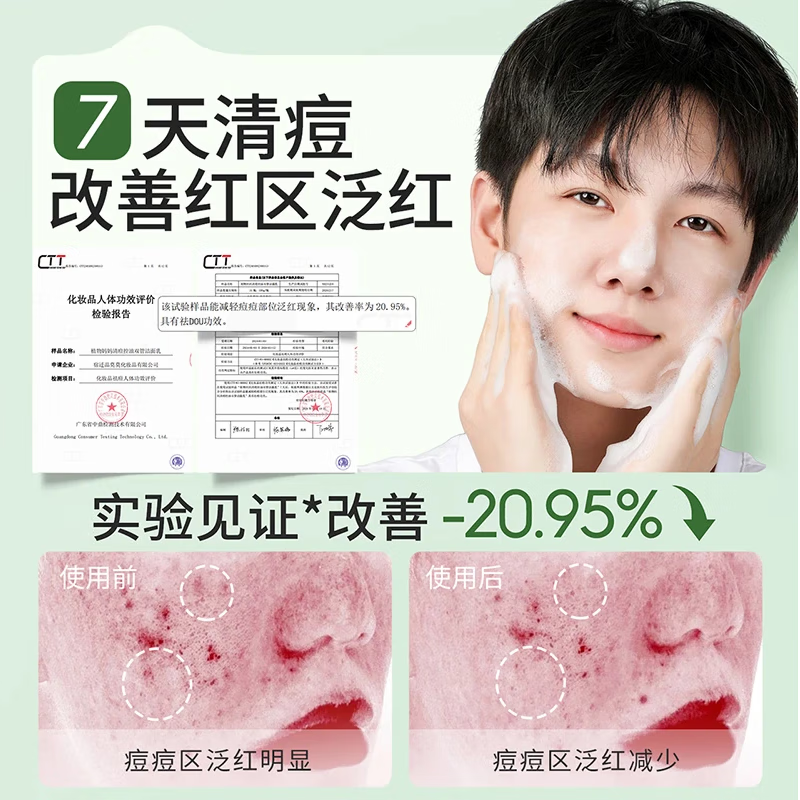 植物妈妈青少年洗面奶12-16岁 青春期祛痘洁面乳男孩女中学生护肤品控油 【祛痘去黑头】洁面乳1只