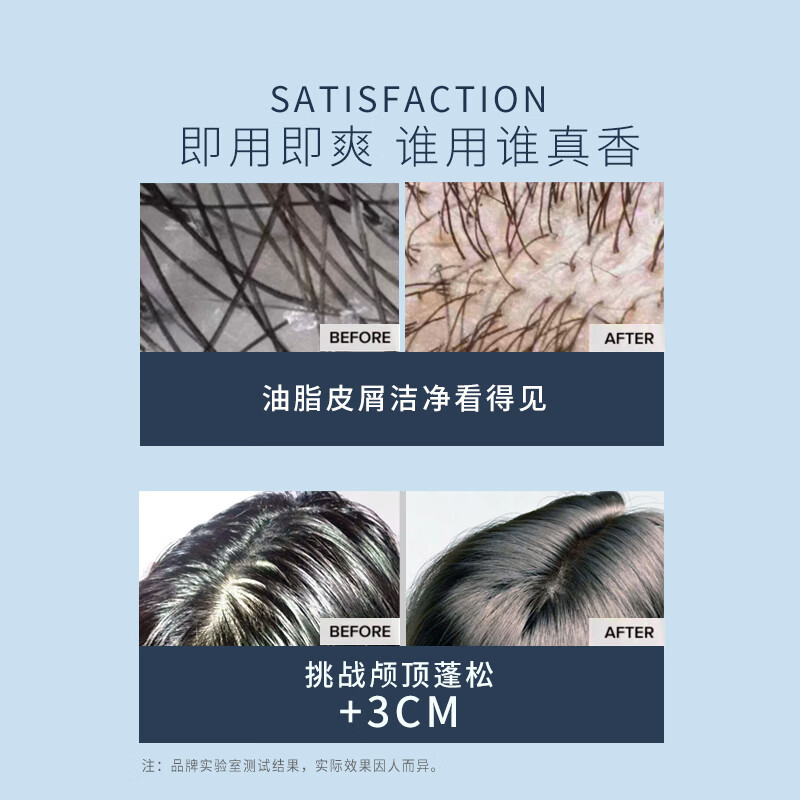 珍妮诗（janese）沙龙无硅油舒爽洗发水蓬松轻盈男女士顺滑柔顺保湿洗发露 【重度油头用】舒爽清油 420g*1瓶