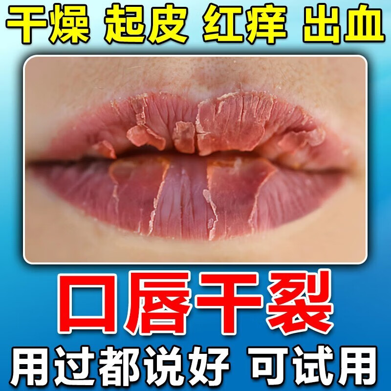 中药唇膏(中药唇膏的好听的名字)