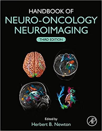 预订 handbook of neuro-oncology neuroimaging