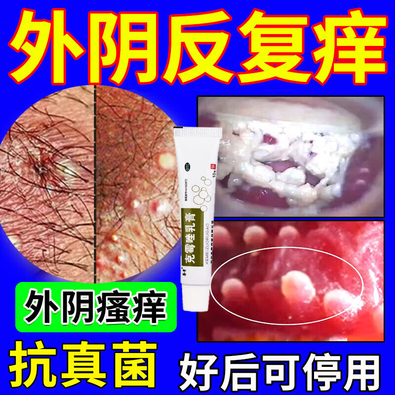 甲硝唑外阴瘙痒妇科专用药女性外阴部瘙痒真菌感染私处痒霉菌性阴道炎