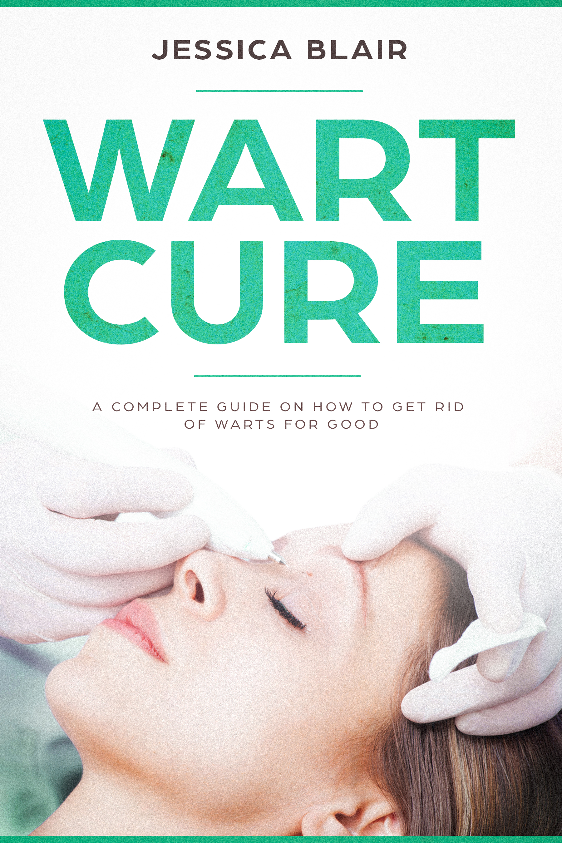 wart cure