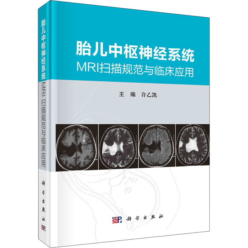 胎儿中枢神经系统MRI扫描规范与临床应用
