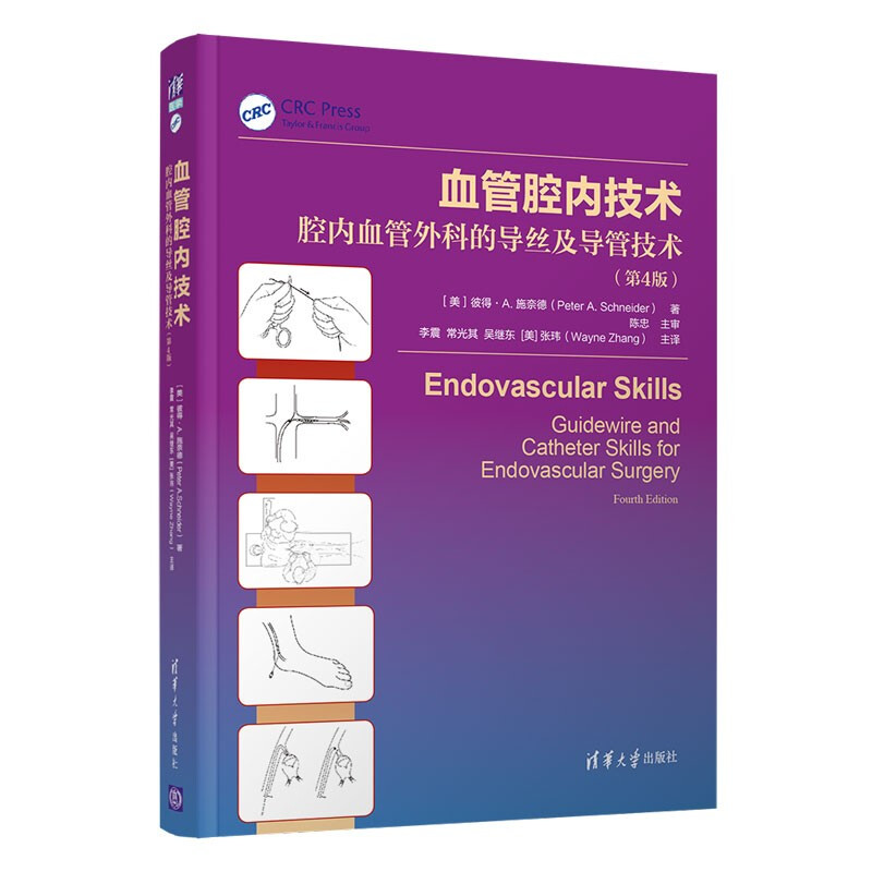 血管腔内技术-腔内血管外科的导丝及导管技术（第4版）清华大学出版社 血管疾病的微创治疗 血管腔内治疗指南