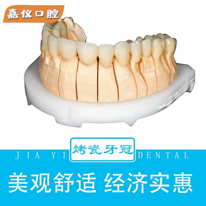 钴铬合金烤瓷牙一颗牙冠牙套不含根管治疗全瓷牙桩镶牙修复美容牙冠