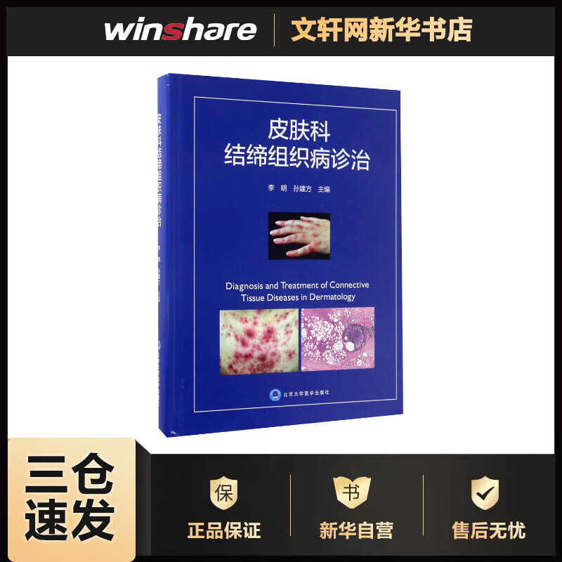 皮肤科结缔组织病诊治 李明,孙建方 主编 书籍