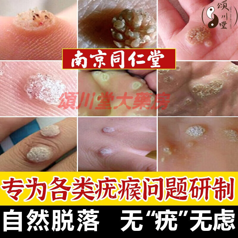疣瘊净搭乳膏去疣尖锐湿疣去除肉粒刺猴跖疣扁平疣 三盒疗程装