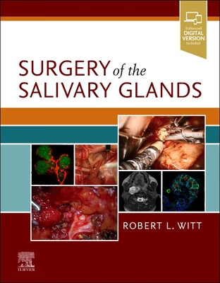 预订 surgery of the salivary glands