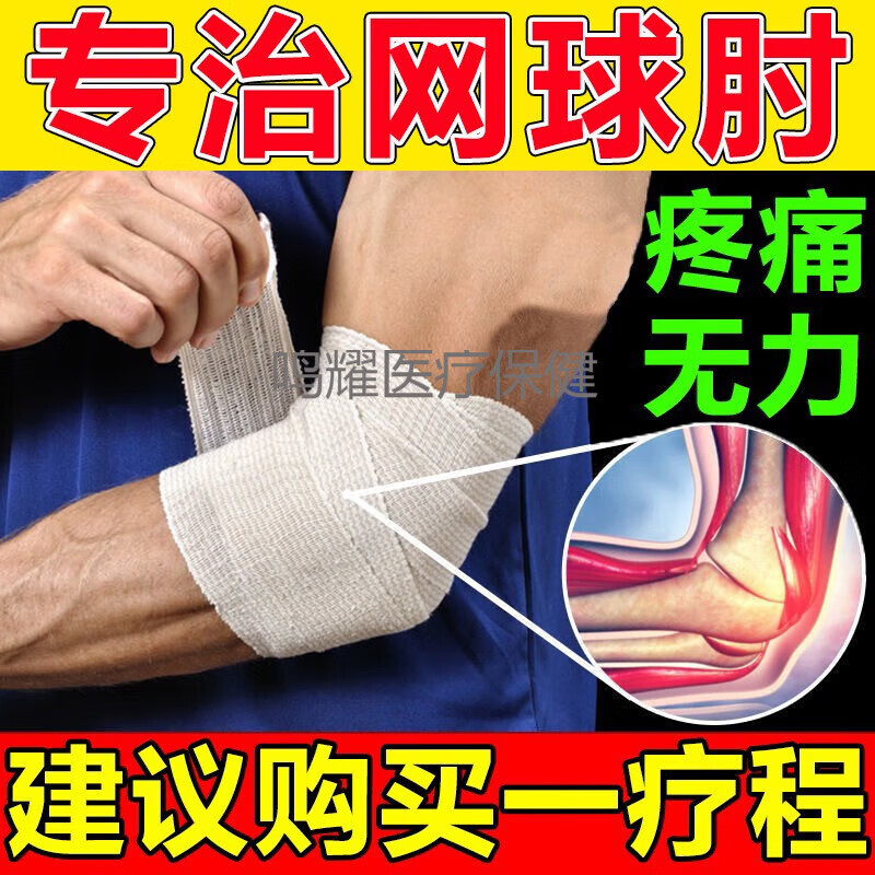 网球肘特有效专用膏贴药非日本护肘具喷剂热敷贴 买2送1【网球肘好治