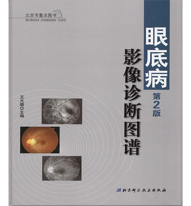 正版现货 眼底病影像诊断图谱(第2版) 王光璐 北京科学技术出版社